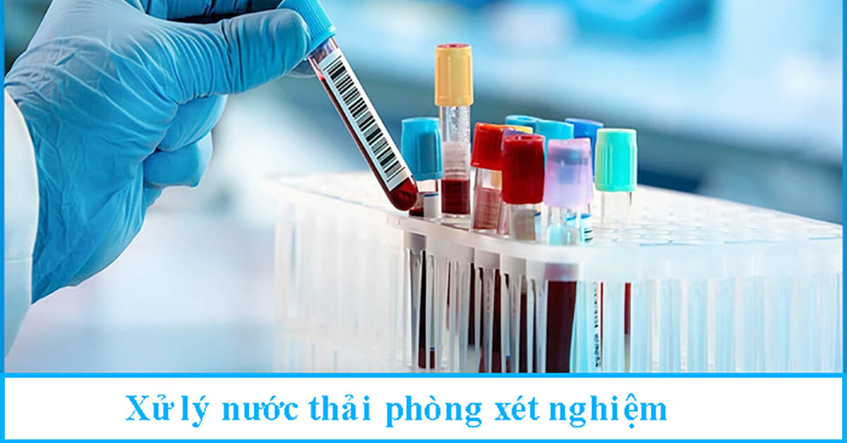 Xử lý nước thải phòng xét nghiệm