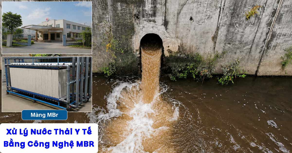 Xử Lý Nước Thải Y Tế Bằng Công Nghệ MBR
